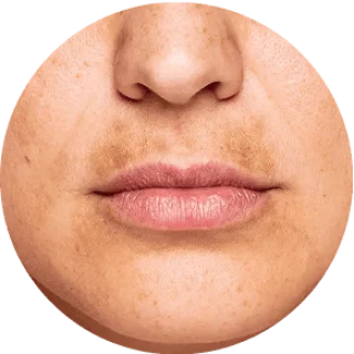 Uneven tone