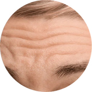 Deeper-looking lines